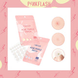 Pink Flash Acne Pimple Patch