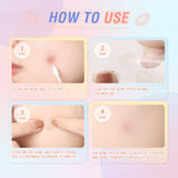 Pink Flash Acne Pimple Patch