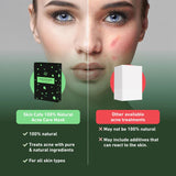 Skin Cafe Acne Care Mask