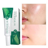 Laikou Aloe Vera ACNE Removal Gel – 20g