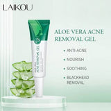 Laikou Aloe Vera ACNE Removal Gel – 20g
