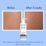 Wishcare AHA + BHA Body Lotion (200ml)