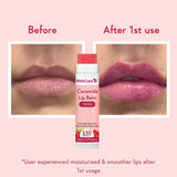 Wishcare Ceramide Lip Balm SPF 50 PA+++ | Lip Treatment with Kojic Acid | Pink Flash BD